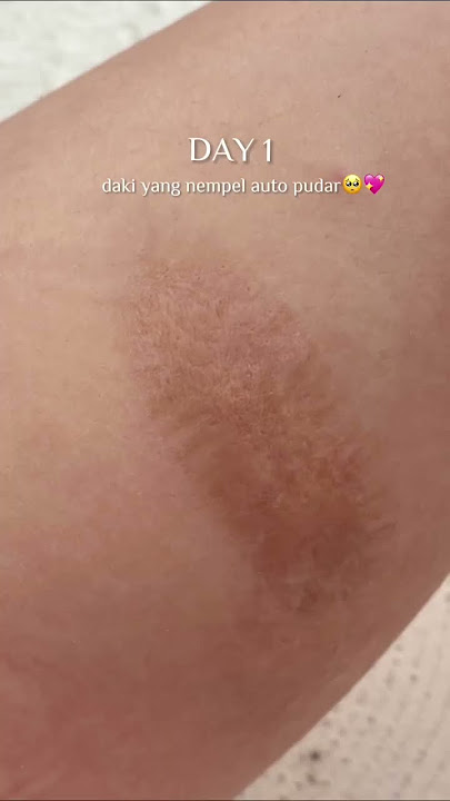 BEKAS LUKA SULIT HILANG? WAJIB TONTON SAMPE SELESAI😨😶‍🌫️