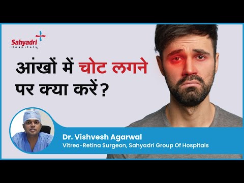 वीडियो: क्या हिम्मत की आंख चली गई?