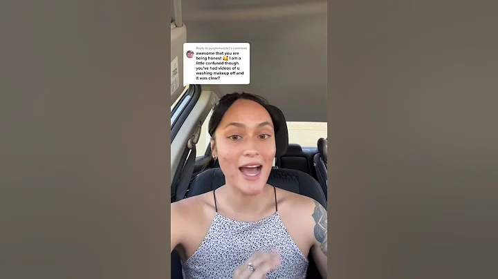 Reply to @purplemurple1  Day 1 post morpheus8 treatment for acne scars