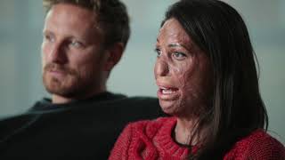 Turia Pitt, burn survivor and recipient of skin grafts