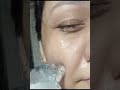 summer me icing karna chahiye ya nahi