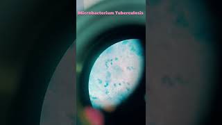 microbacterium Tuberculosis Under Microscope 😲😲🔬#mtb #shorts #microbiology