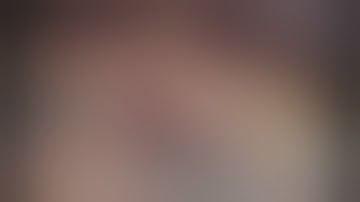 Laparoscopic Extended Right Posterior Sectionectomy; Glissonean approach