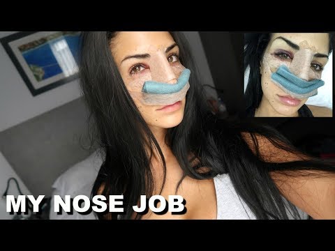 My Nose Job
