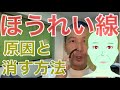 ほうれい線の原因 中目黒整体レメディオ