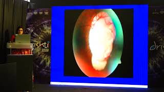 Ksos2022 Dr Natasha Radhakrishnand1 He S8 T Congenital Optic Nerve Anomalies