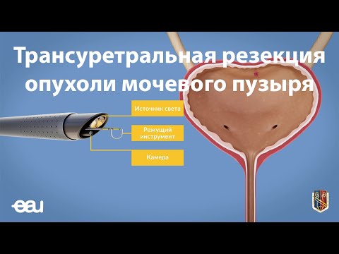 Видео: Рассекая клеточное старение и SASP у дрозофилы