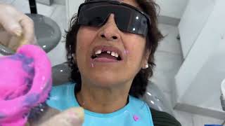 Prótesis removible si no hay para implante #dientes #dentista #tips #parati #viral #fyp #shorts by Oralay Dental 807 views 3 months ago 3 minutes, 41 seconds