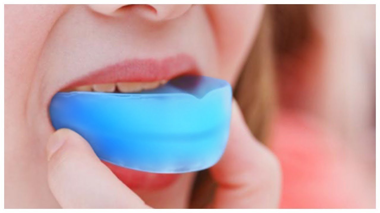 можно ли исправить прикус зубов - YouTube