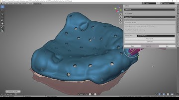D3Denture - Custom Tray