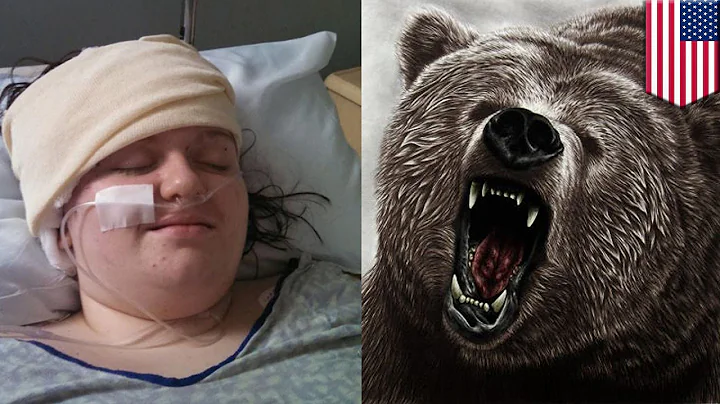 Teen survives bear attack: 15-year-old girl plays ...