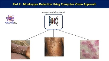 Monkeypox Detection using Computer Vision in Python | Computer Vision Project in Python | Part 2