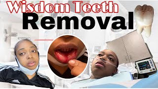 I got FOUR Wisdom Teeth Removed | *Oral Surgery VLOG * + recovery tips 🦷