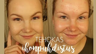 Rasvoittuvan Ihon Syväpuhdistus Kauneustube