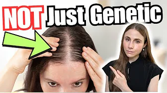 The Real Reason Your Hair Is Thinning (It’s NOT Just Genetics)