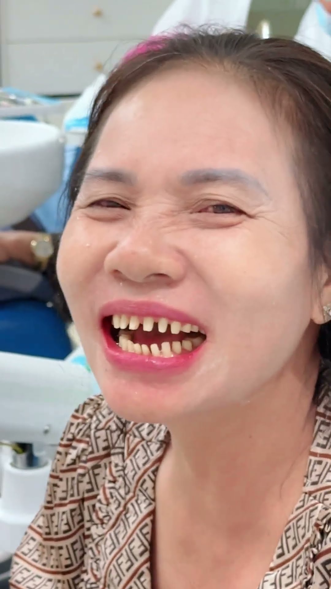 Ben Eagle đưa cả gia đình 3 thế hệ đi làm răng sứ tại Emedic Dental [BEN EAGLE] #beneagle #kungfu