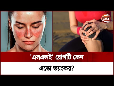 ভিডিও: গবেষণা একটি উপসর্গ আছে?