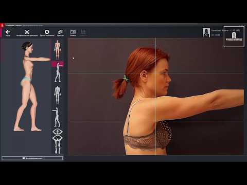 Как проходит картирование тела с использованием FotoFinder ATBM bodystudio