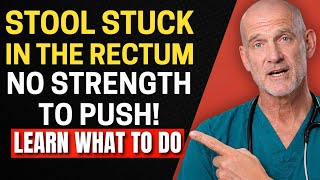 Stool STUCK in the Rectum! What is it and what to do | Doctor Explains