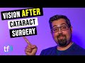 Vision After Cataract Surgery / What's Next? - Eye Doctor Explains