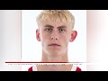 Nebraska Men's Basketball Freshman Colin Rice Sidelined With Hand Injury