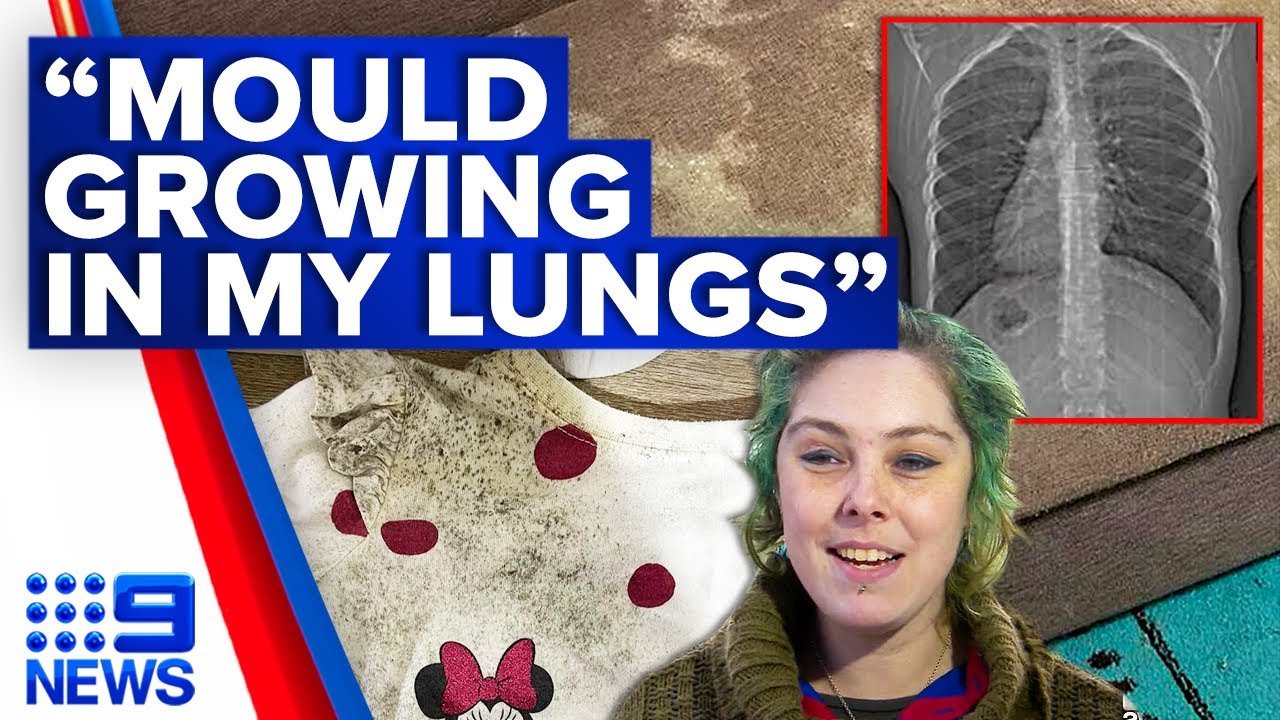Young woman warns of health risks of Australia’s mould crisis | 9 News Australia