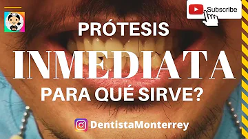 ¿Qué son las prótesis dentales definitivas?