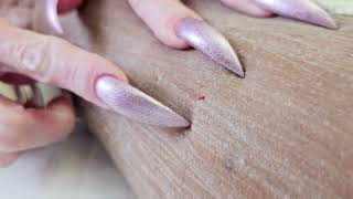 Sharp nails scratching skin!!!!