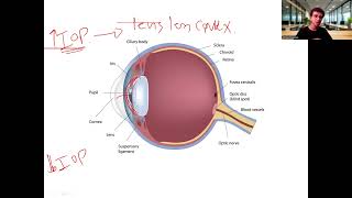 2- Vision I (IOP \& Glaucoma)