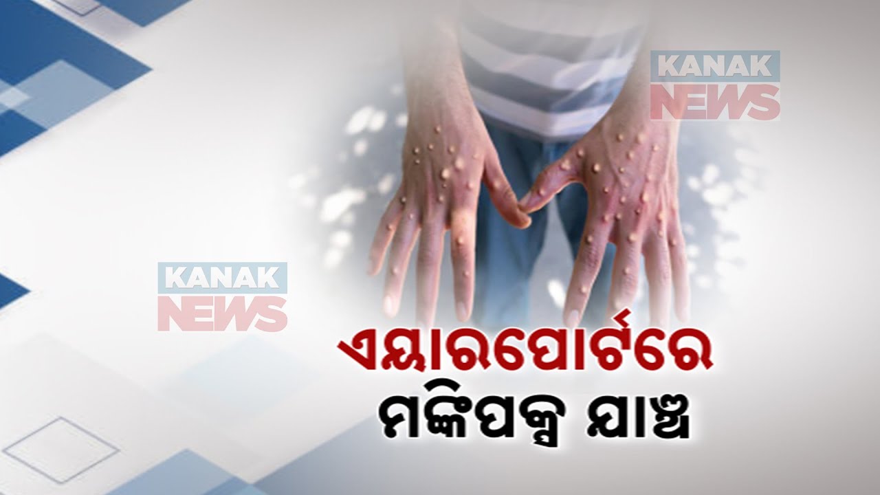 India Reports First Suspected Case Of Monkeypox | Symptoms, Cause And ...
