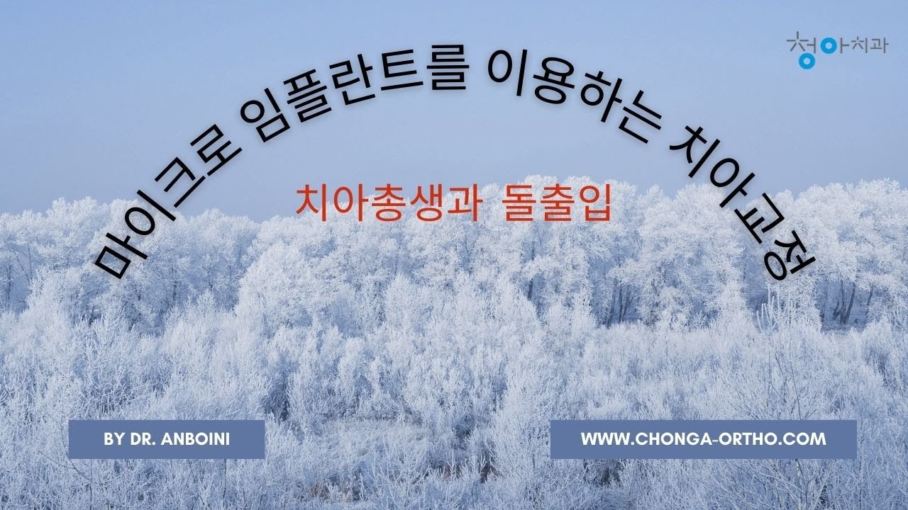 마이크로 임플란트를 이용하는 치아교정: 치아총생과 돌출입