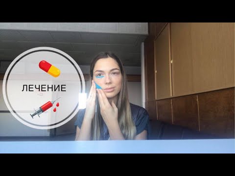 Video: Parēze - Parēzes Cēloņi Un Simptomi, Diagnostika, ārstēšana Un Profilakse