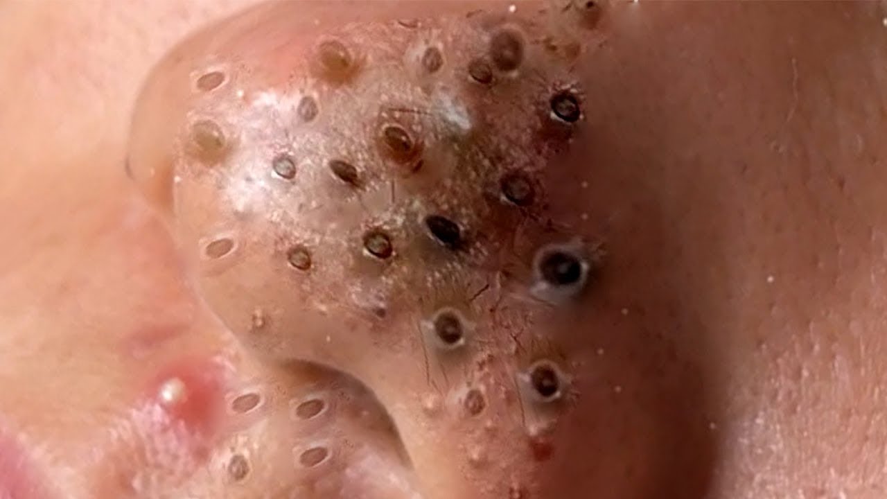 𝑺𝒐𝒐𝒕𝒉𝒊𝒏𝒈 𝑭𝒂𝒄𝒊𝒂𝒍 𝑻𝒓𝒆𝒂𝒕𝒎𝒆𝒏𝒕 𝒇𝒐𝒓 𝑺𝒕𝒓𝒆𝒔𝒔 𝑹𝒆𝒍𝒊𝒆𝒇 | 𝑫𝒆𝒆𝒑 𝑪𝒍𝒆𝒂𝒏𝒊𝒏𝒈 & 𝑪𝒂𝒍𝒎𝒊𝒏𝒈 𝑴𝒂𝒔𝒔𝒂𝒈𝒆 𝒂𝒕 𝑳𝒖𝒙𝒖𝒓𝒚 𝑺𝒑𝒂 #1005102