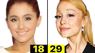 What Happened to Ariana Grande's Face? | Plastic Surgery Analysis