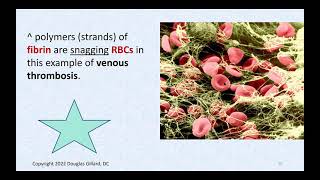 Thrombosis, Embolisms, Factor V Leiden Mutation, Lymphedema, Lymphadenitis, and Cellulitis.