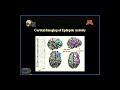 Adding fMRI to EEG
