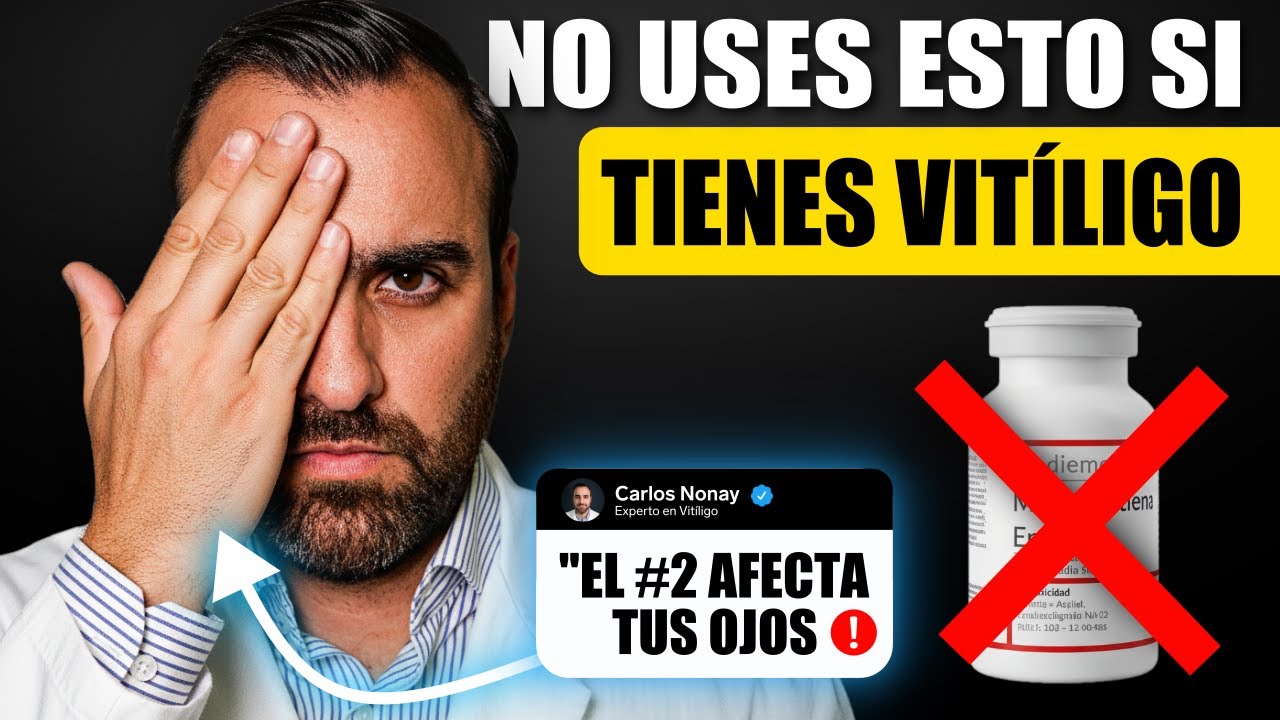 3 MEDICAMENTOS que NO DEBERÍAS USAR jamás si tienes VITILIGO (y nadie te lo dice)