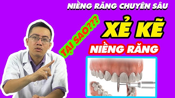 TẠI SAO PHẢI MÀI KẼ/XẺ KẼ RĂNG TRONG NIỀNG RĂNG?