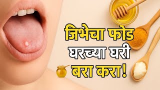 Jibhela phod yene upay | जिभेला फोड येणे घरगुती उपाय | jibhela fod yene upay |jibhevar fod yene upay