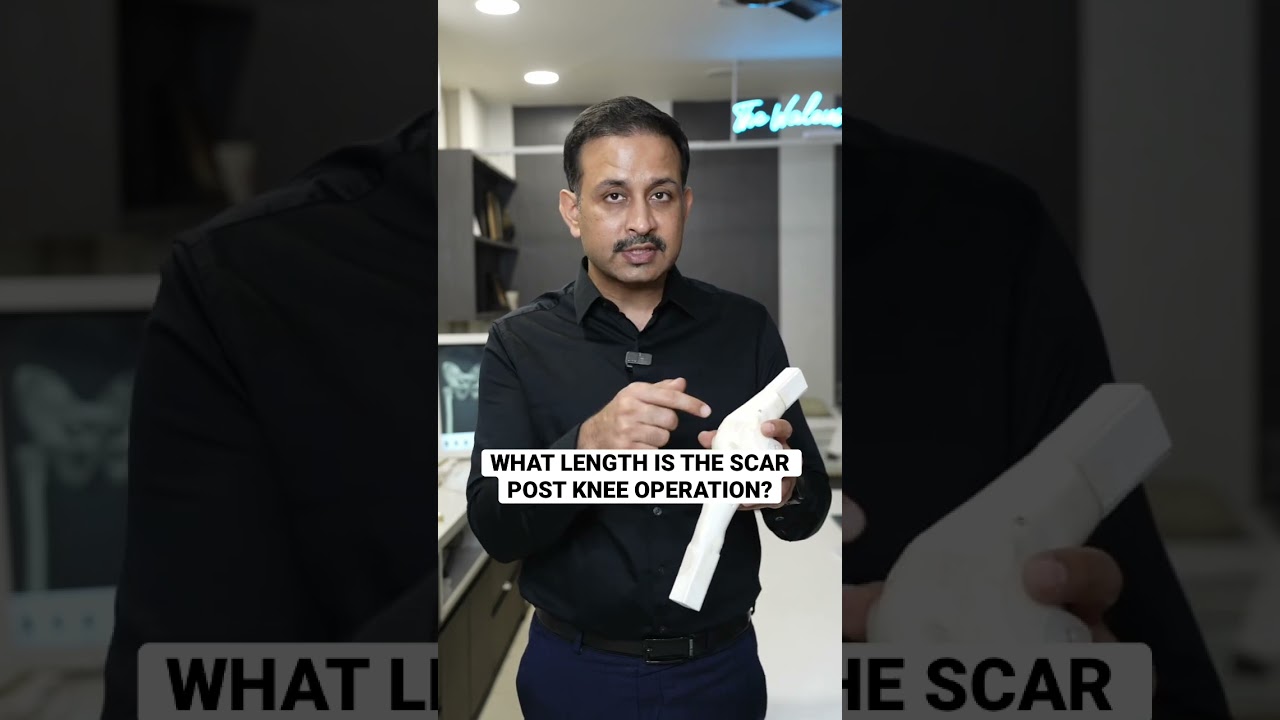 Where will be my knee surgery scar? 