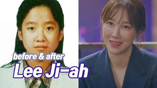 Lee Ji-ah before and after