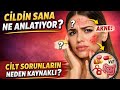 Cildin Sana Ne Anlatıyor? Sivilce ve Lekelerin Gerçek Nedeni Ne?#ciltbakımı #sivilce #akne #skin 