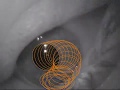 Saccade Detection Benchmarks for the HTC Vive - Pupil Labs Eye Tracker