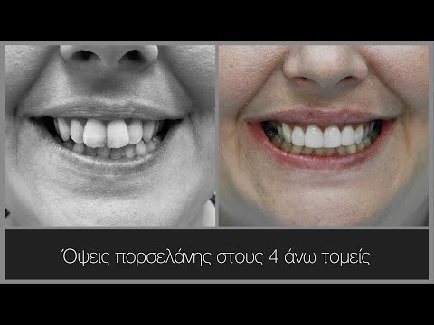 Αποκατάσταση των τεσσάρων