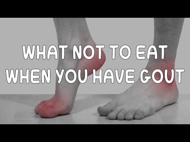 [GOUT] - What Not to Eat When You Have Gout - AzchanneL class=