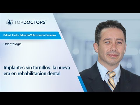 Implantes sin tornillos: la nueva era en rehabilitación dental