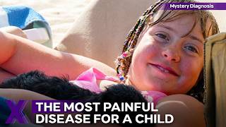 A Rare Disease Affecting 1 In 50,000 People | Mystery Diagnosis | Season 3 Episode 7