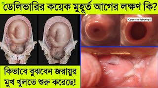 ডেলিভারির আগে জরায়ুর মুখ খোলার লক্ষণ কি কি? || বাচ্চা হওয়ার কিছুক্ষণ আগে কি লক্ষণ প্রকাশ পায়? দেখুন!