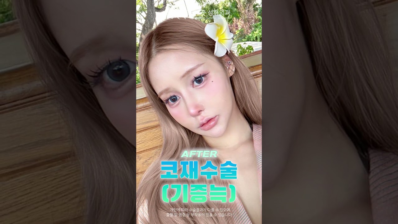 [Bệnh viện phẫu thuật thẩm mỹ Very Good] Chỉ làm mũi mà đã mang cảm giác của Jiselle #Phẫu thuật thẩm mỹ Gangnam #Phẫu thuật lại mũi #Phẫu thuật mũi