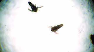 One of the two tiny artemia salina nauplius is flapping wings under the microscope